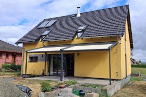 Pergola Linie, 3 620 × 2 850 mm (2ks), RAL V05 (podobná RAL 7016) antracit se strukturou, realizace Bohemiaflex CS