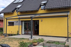 Pergola Linie, 3 620 × 2 850 mm (2ks), RAL V05 (podobná RAL 7016) antracit se strukturou, realizace Bohemiaflex CS