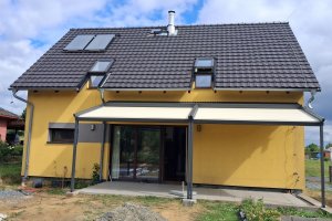 Pergola Linie, 3 620 × 2 850 mm (2ks), RAL V05 (podobná RAL 7016) antracit se strukturou, realizace Bohemiaflex CS